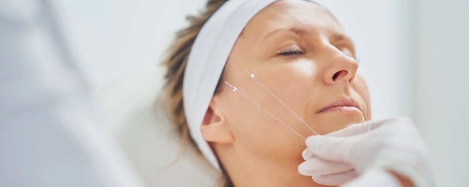 What Is the Difference Between PDO and PLLA Thread Lift in Islamabad?